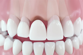create realistic 3d dental animation for implants and procedures animation