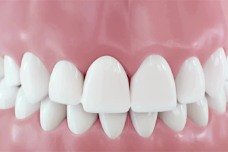 create 3d dental implant animation, oral surgery and medical explainer video