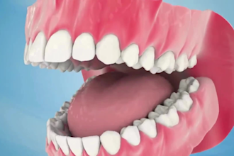 create realistic 3d dental impact and medical animation video