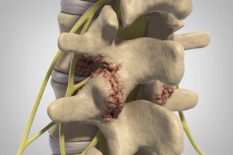 do 3d medical animation spine surgery orthopedic anatomy 3d medical device video