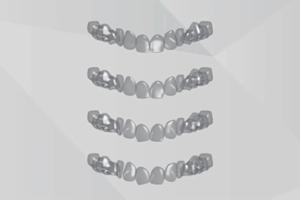 3d dental teeth animation 3d medical device animation 3d dental surgery implant