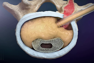 create 3d medical device animation for medtech and healthcare companies