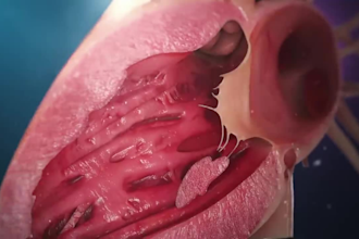 create realistic 3d surgical and anatomy animation, scopic vision