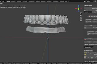 design dental crowns, bridges and implants using exocad