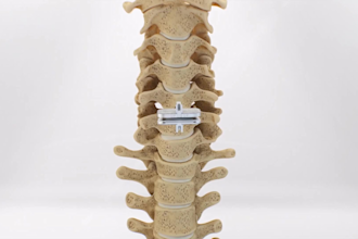 create 3d medical device animation and product visualization
