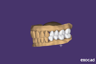 provide expert exocad dental cad design services