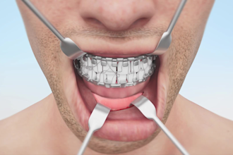 do 3d medical animation, dental animation, mandible surgery and anatomy video