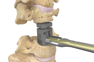 do 3d medical animation surgical visualization orthopedic medical device video