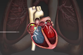 3d cardiovascular system and heart disease medical animation