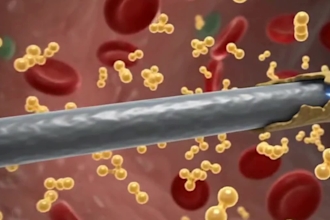 do 3d medical animation, surgery animation, video animation, surgery animation