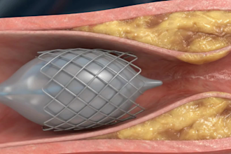create professional ai medical explainer and anatomy animations