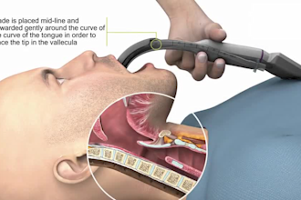 do ai 3d medical animation, surgical procedure, anatomy video, cgi injury