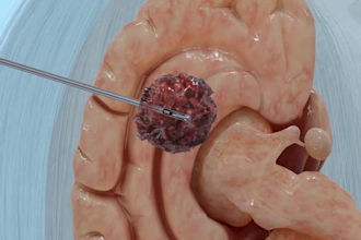 do 3d medical animation, anatomy, surgical animation, anatomical visualization