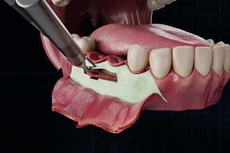 create 3d dental and oral animation for implants braces and procedures