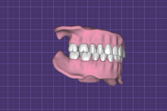 design crowns, bridges and many more using exocad