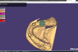 create professional dental cad designs using exocad