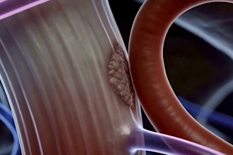 create medical 3d animation, surgical and healthcare explainer