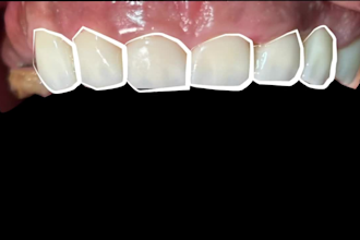 design medical or dental animation videos in after effects