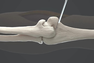do 3d medical animation, surgical animation, anatomy animation explainer video