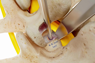 do 3d medical animation surgical devices, biotech and healthcare explainer video