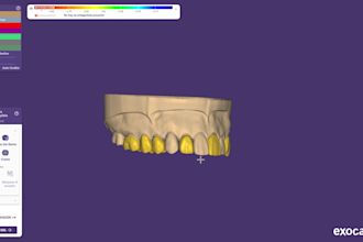 design dental restorations, crowns, bridges, veneers, inlays, all on x, implants