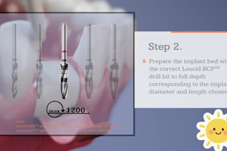design 3d medical forensic animations for legal trials and malpractice lawsuits