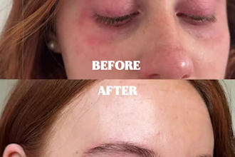 create skincare testimonial ugc video ads with before and after style