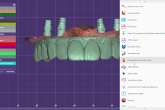 design professional dental restorations using exocad