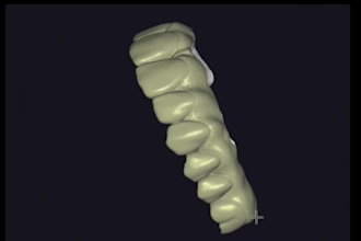 design dental cad crowns, bridges and implants using exocad