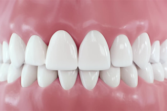 create realistic 3d dental implant oral surgery animation 3d medical animation