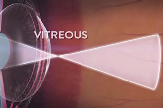 3d medical animation, body anatomy, 3d surgery animation explainer video