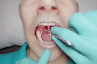 3d medical animation 3d medical device animation 3d healthcare animation