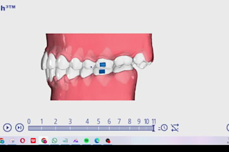 create orthodontist verified 3d clear aligner treatment planning and stl setups