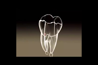 3d dental medical animation for skeleton virus anatomy and surgery video