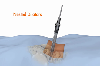 create 3d medical animation, surgery animation, medical device video