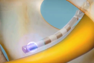 do 3d medical animation, medical device, biomedical treatment and moa animation