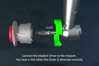 do 3d dental implant animation 3d medical animation 3d dental procedure video