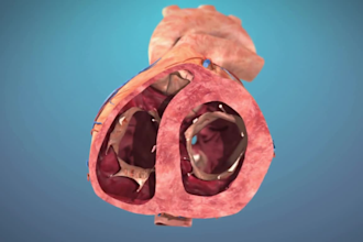 3d medical animation 3d anatomy video surgery animation medical explainer video