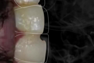 do professional dental photo editing and clinical retouching for social m