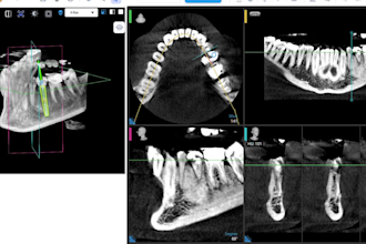 design your digital implant case presentation