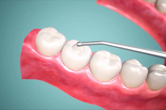 create professional 3d medical animation, surgery, and scientific visuals