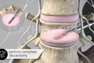 create 3d medical device animation surgical visualization and product demo