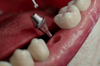 create realistic 3d medical animation video