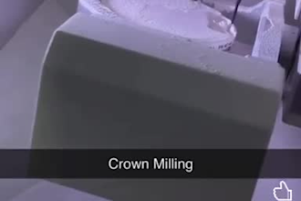 design top notch dental crowns bridges and dentures