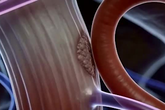 3d anatomy  dental animation medical animation  healthcare video explainer video