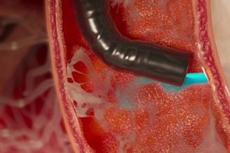 do 3d medical animation anatomy visualization biotech and pharma moa explainer