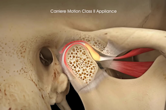 create professional 3d dental medical animation 3d orthodontic surgery procedure