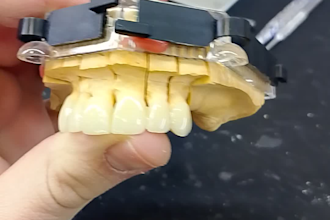 design dental prothesis all on using exocad