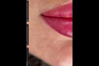 retouch lip filler and permanent makeup photos