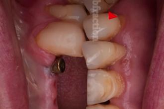 create dental video ads and motion graphics for clinics and ai ads